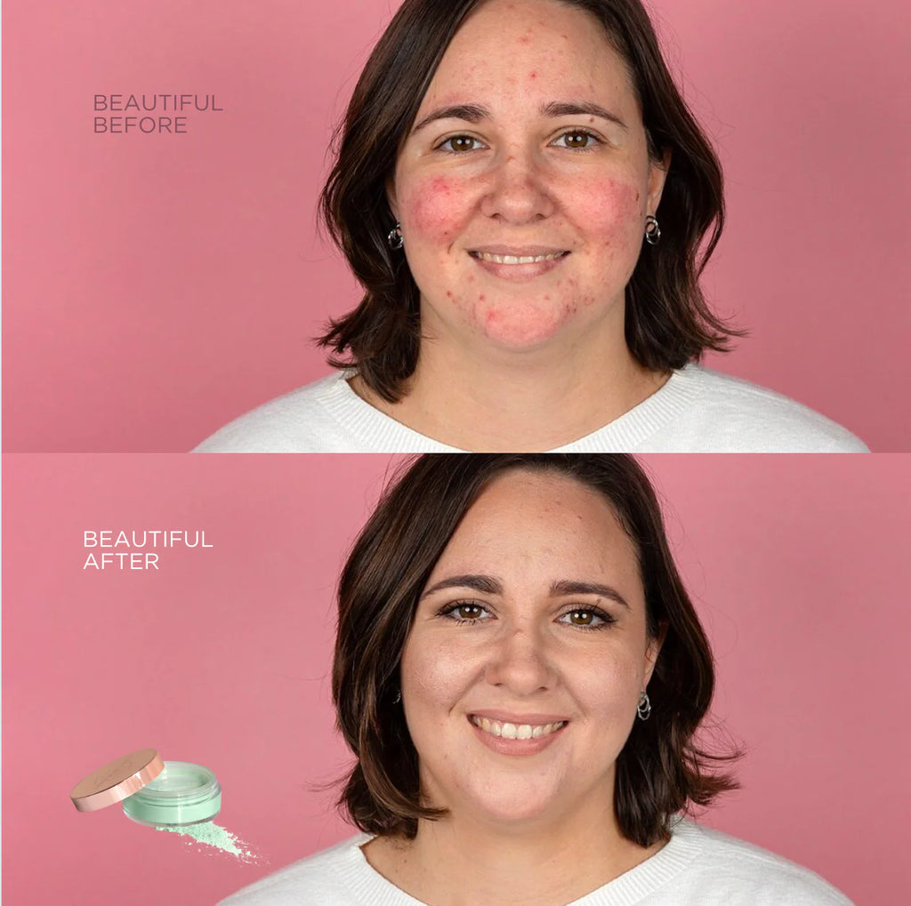 Anti-Redness Loose Powder