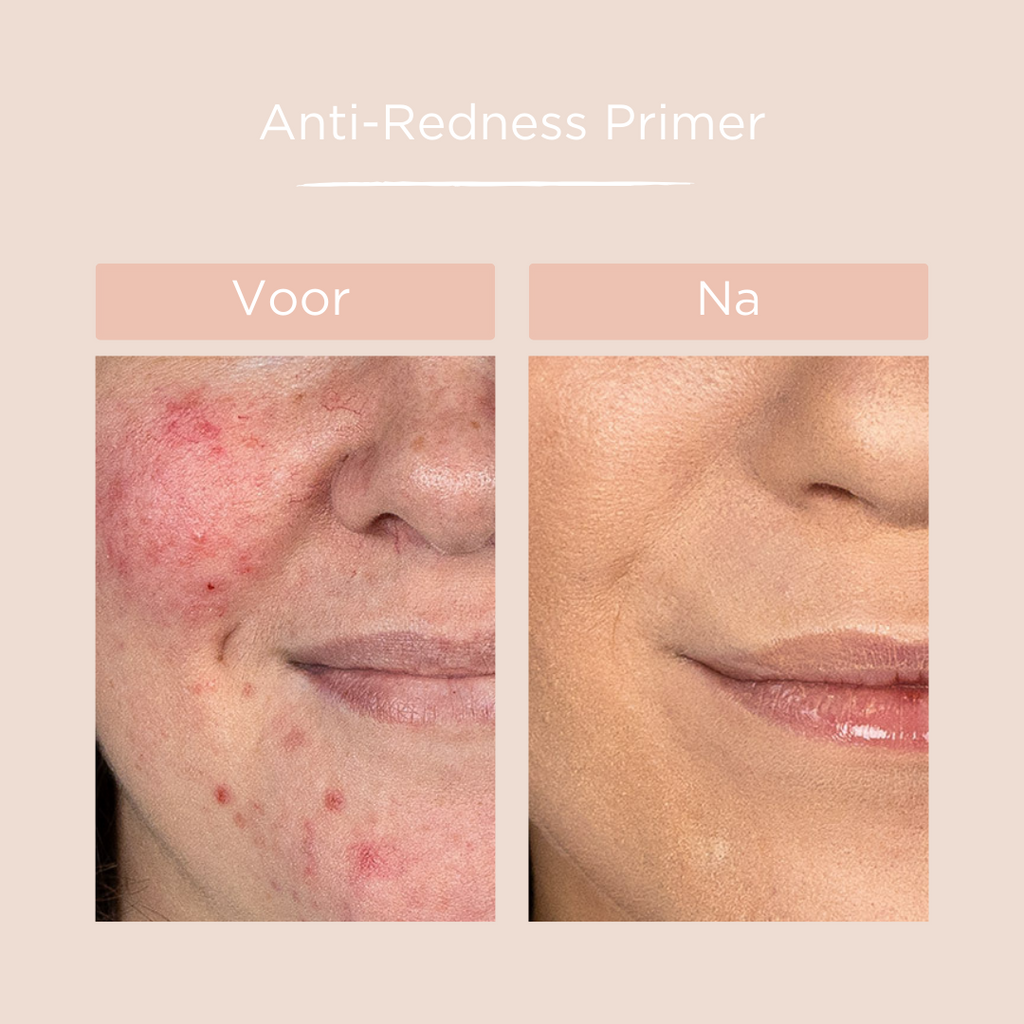 Voor & na primer
